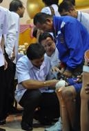 นพ.ชลน่าน ศรีแก้ว ใส่ขาเทียมให้คนพิการ