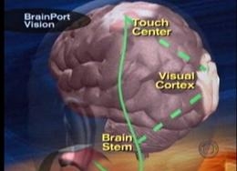 สื่อทางการแพทย์ แสดงภาพจำลองการมองเห็นของดวงตาคนไม่ปกติหรือตาบอด