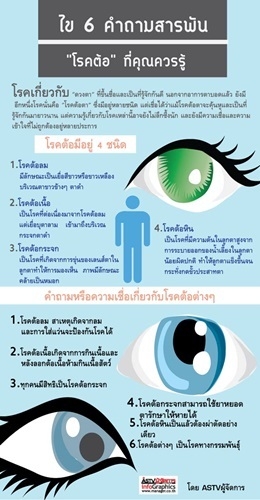 ไข 6 คำถามสารพัน "โรคต้อ" ที่คุณควรรู้