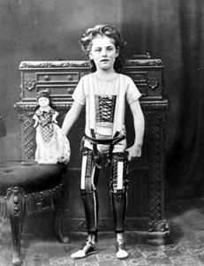 Artificial legs, UK, ca. 1890