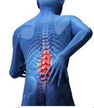 แสดงอาการปวดหลัง