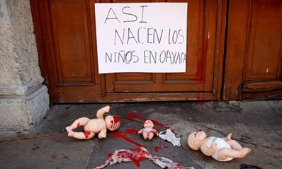 องค์กรด้านสิทธิมนุษยชน “อาร์ซีไอจี” ของเม็กซิโก  ต่อต้านการคลอดลูกทิ้งข้างถนน