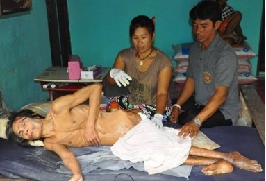 นายไพโรจน์ พงษ์พินยาพิบูลย์นอนช่วยเหลือตนเองไม่ได้