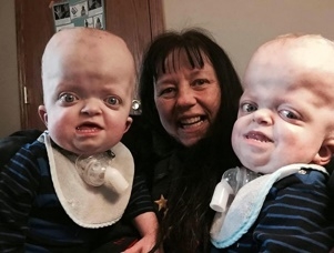 Linda Trepanier วัย 58 ปีรับเลี้ยงเด็กน้อยฝาแฝด