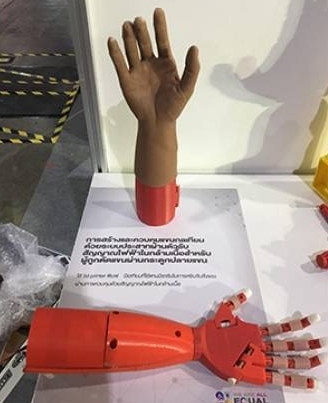 ‘มือเทียมกล’ ควบคุมผ่านสัญญาณไฟฟ้าในกล้ามเนื้อ เพื่อคนพิการ