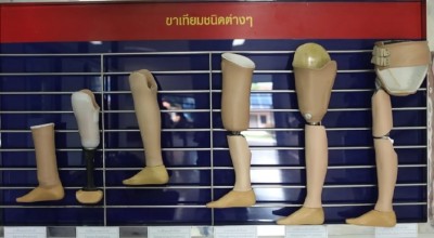 ‘ขาเทียม’ฟรี ! ผู้พิการทุกคน-ทุกสิทธิรักษา-ทุกเชื้อชาติ