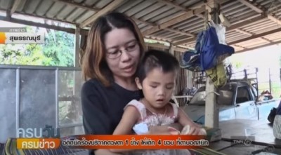 หญิงอายุ 48 ปี สละดวงตา1ข้างให้หนูน้อยตาบอด