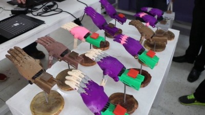 มูลนิธิสายใจไทยผนึก รพ.สิรินธร ทุ่มพลังผลิตมือเทียมเพื่อผู้พิการทั้งประเทศ