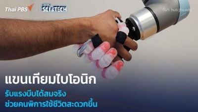 แขนเทียมไบโอนิก รับแรงบีบได้เหมือนมือจริง ช่วยคนพิการใช้ชีวิตสะดวกขึ้น