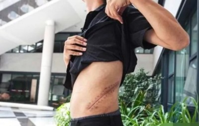 ชะตากรรมหนุ่มจีน พิการ-นอนติดเตียง หลังขายไตซื้อไอโฟน-ไอแพด