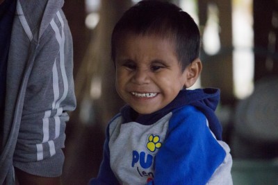 ชีวิตเลือกเกิดไม่ได้ !! “น้องบาส” เด็ก 7 ขวบ พิการสมอง-เดินไม่ได้ อาศัยอยู่กับยาย ทุกข์ซ้ำแม่ตกงาน ครอบครัวยากจนไร้ที่พึ่ง หวังผู้ใจบุญเมตตา