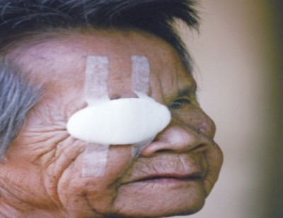 ดูแลสุขภาพผู้สูงวัยที่อยู่ในโลกมืด เรื่องใกล้ตัวที่ลูกหลานอย่ามองข้าม