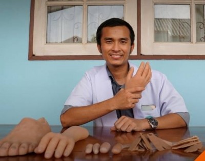 "มือ-นิ้ว-เท้า" เทียมเพื่อทดแทน สร้างความมั่นใจ เหมือนไม่พิการ